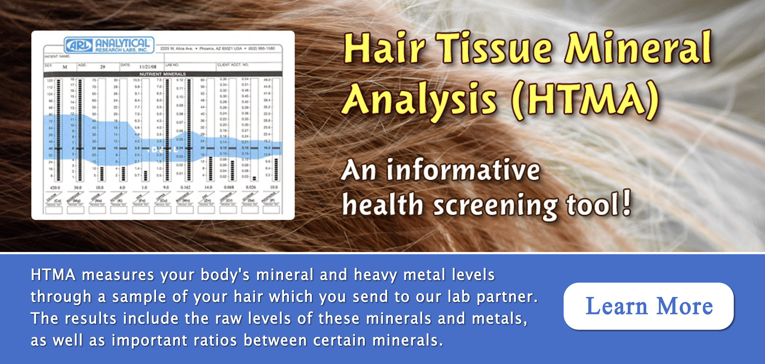 HTMA
