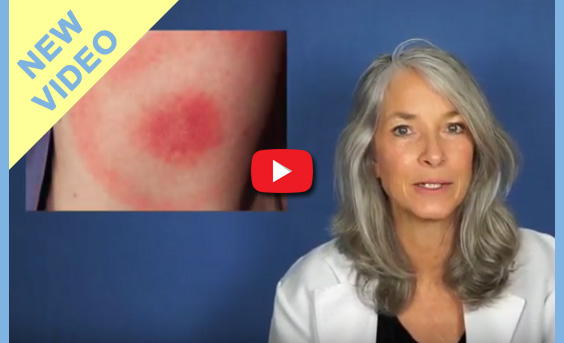 essential oils for Lyme disease